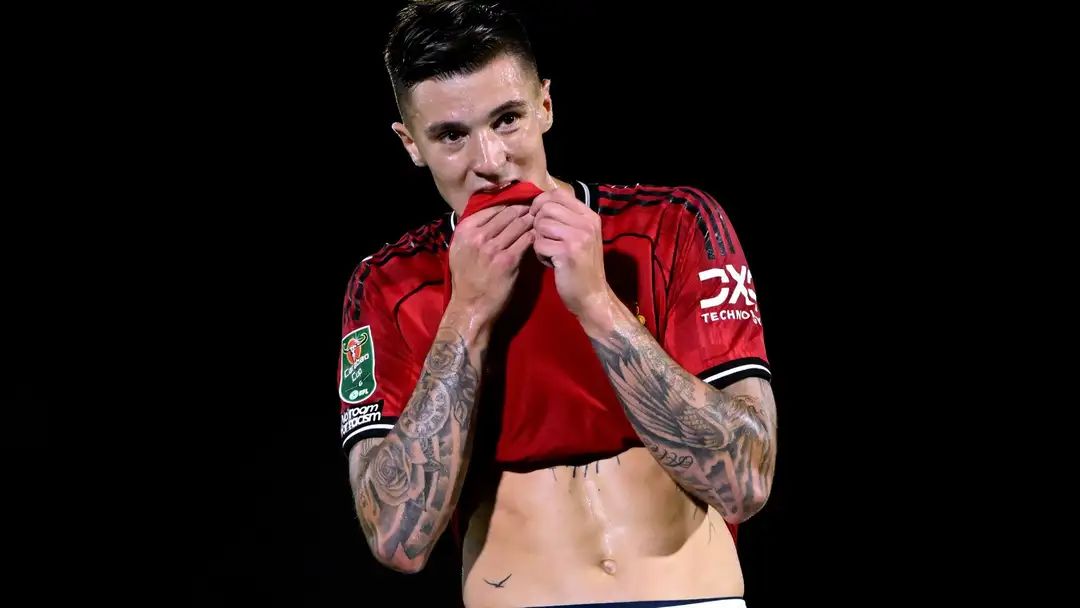 ผีกังวล หลังเชชโก้เจ็บ ต้องพักประมาณหนึ่งเดือน