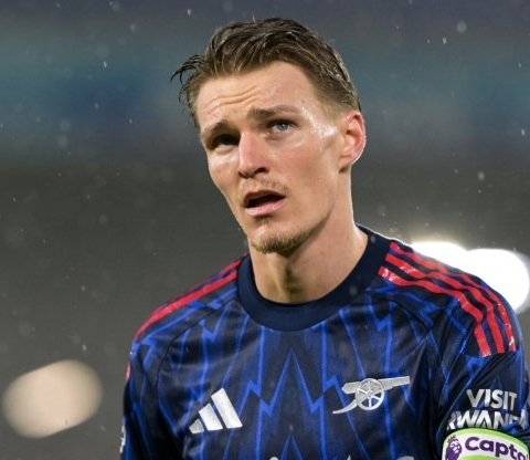 อาร์เตต้าแจงเหตุโอเดการ์ดไร้ชื่อ หลังมีอาการบาดเจ็บ